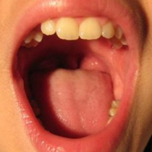 A mouth