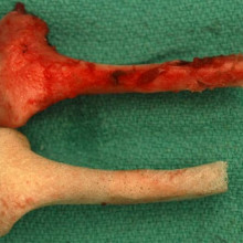 Researchers used a precision carved scaffold made from cow bone to replace a section of a pigs jaw.