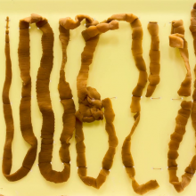 Tapeworm (Taenia species)