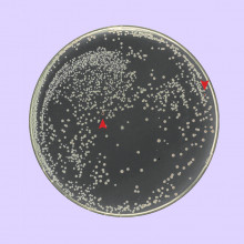 Radiation Resitant E. coli