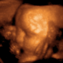 \3D Ultrasound\ of a baby aged 29 weeks.