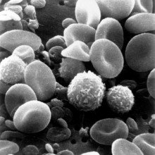 Electron microscopy of blood cells and platelets