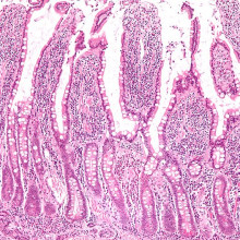Low magnification micrograph of small intestinal mucosa. H&E stain.