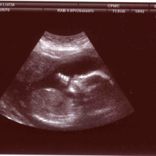 Foetus in ultrasound