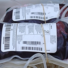 Bags of blood collected during donation, showing dark colour of venous blood.