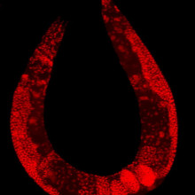 Wild-type C. elegans hermaphrodite stained to highlight the nuclei of all cells