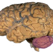 A picture of a brain with the cerebellum in purple