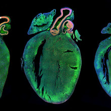  Neonatal rat hearts treated with a control microRNA (left) or two human microRNAs strongly increasing cardiomyocyte proliferation (middle and right). The picture shows the presence of several, replicating (red) cells in the muscular mass of the left...