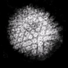 Electron micrograph of HSV particles