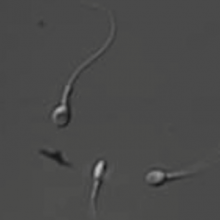 Human sperm