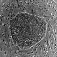 human embryonic stem cell colony