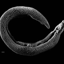 Electron micrograph of an adult male Schistosoma parasite worm. The bar (bottom left) represents a magnification of 0.5mm.