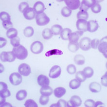 A photomicrograph of a blood smear containing a macrogametocyte of the parasite Plasmodium falciparum.