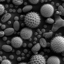 An SEM of pollen grains, a common cause of allergic reactions