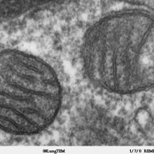 Transmission electron microscope image of a thin section cut through an area of mammalian lung tissue. The high magnification image shows a mitochondria. JEOL 100CX TEM