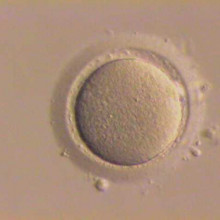 \Stripped\ human oocyte (egg cell); granulosa cells that had surrounded this oocyte have been removed.