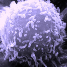 Electron microscopic image of a single human lymphocyte.