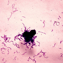 Gram stained Streptococcus mutans