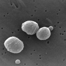 Scanning Electron Micrograph of Streptococcus pneumoniae. Pneumococcus, Streptococci