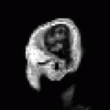 An animated gif of MRI images of a human head (smaller)