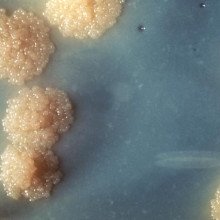 Mycobacterium Tuberculosis Culture