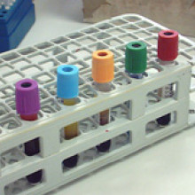 A range of vacutainer tubes containing blood samples
