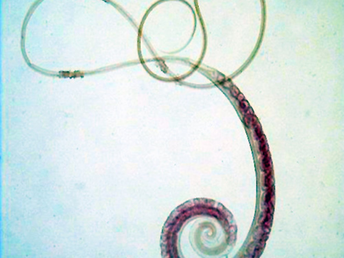 Круглые черви заболевания. Трихоцефалез – власоглав. Власоглав Trichocephalus Trichiurus.